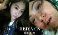 辽宁酒吧女歌手拒陪酒遭毒打视频照片  小希微博个人资料照片曝光