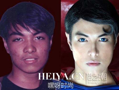 菲律宾男子查韦斯整容23次成现实版超人 只为圆心中儿时英雄梦_shangc.net
