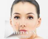 经常长痘的原因有哪些   怎样可以摆脱恼人的痘痘