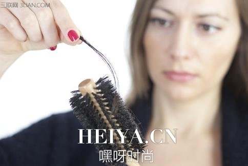 掉头发很厉害怎么办？ 