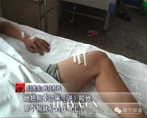 河南放狗咬人女子人肉背景个人资料照片 女子放狗咬人现场照片 河南放狗咬人女子人肉背景个人资料照片 女子放狗咬人现场照片
