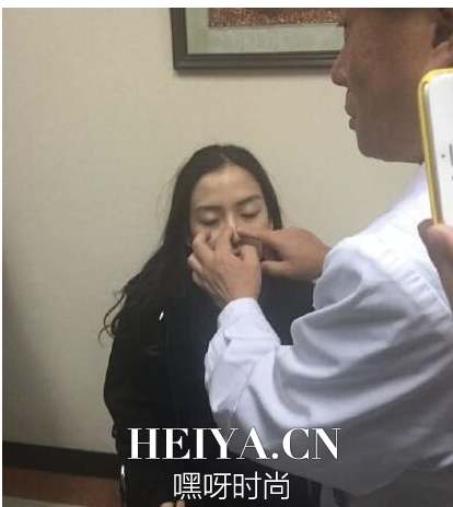 Angelababy面部整容鉴定结果公布  baby整容鉴定完整视频观看 