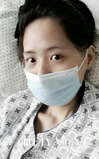夏赛娜个人资料照片父母是谁做什么的  24岁女孩夏赛娜捐眼角膜