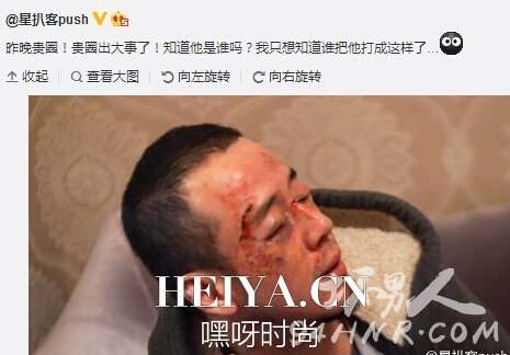 杨坤被打是真的吗 杨坤为什么被打 曝杨坤被打幕后真相
