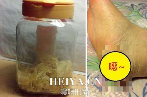 图片来源于网络