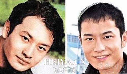 黄晓明早期发量稀少
